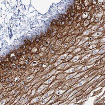 Immunohistochemistry: RHCG Antibody [NBP2-30825]