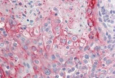Immunohistochemistry-Paraffin: RHCG Antibody [NBP1-52089]