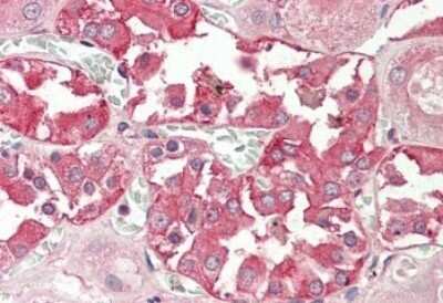 Immunohistochemistry-Paraffin: RHCG Antibody [NBP1-52089]