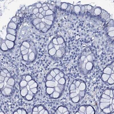 Immunohistochemistry-Paraffin: RHCG Antibody [NBP2-30825]