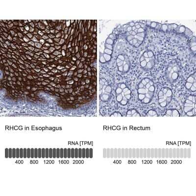 Immunohistochemistry-Paraffin: RHCG Antibody [NBP2-30825]