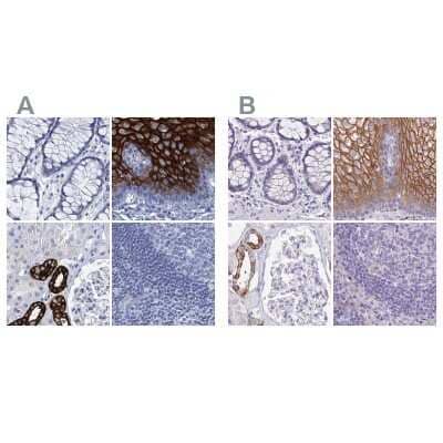 Immunohistochemistry-Paraffin: RHCG Antibody [NBP2-30825]
