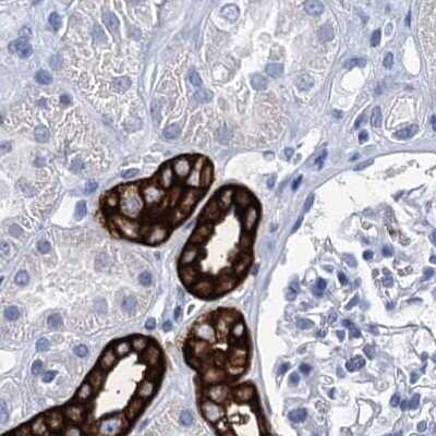 Immunohistochemistry-Paraffin: RHCG Antibody [NBP2-30825]