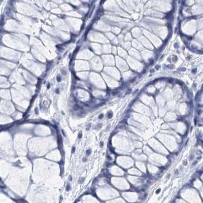 Immunohistochemistry-Paraffin: RHCG Antibody [NBP2-30825]