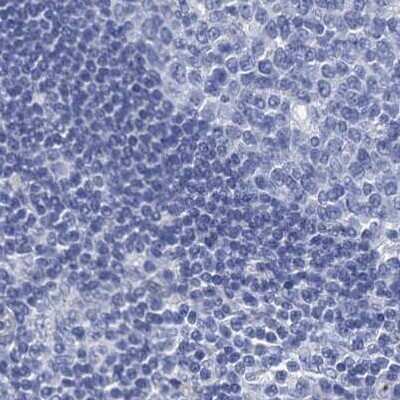 Immunohistochemistry-Paraffin: RHCG Antibody [NBP2-30825]