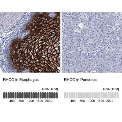Immunohistochemistry-Paraffin: RHCG Antibody [NBP2-30825]