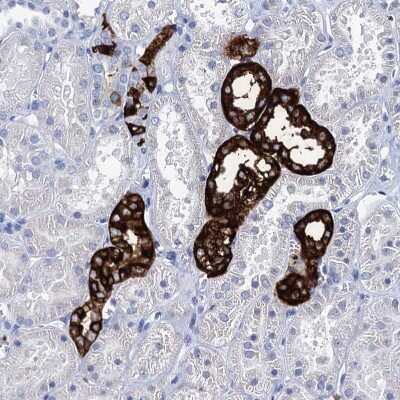 Immunohistochemistry-Paraffin: RHCG Antibody [NBP2-30825]