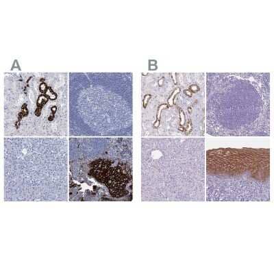 Immunohistochemistry-Paraffin: RHCG Antibody [NBP2-30825]