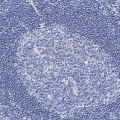 Immunohistochemistry-Paraffin: RHCG Antibody [NBP2-30825]