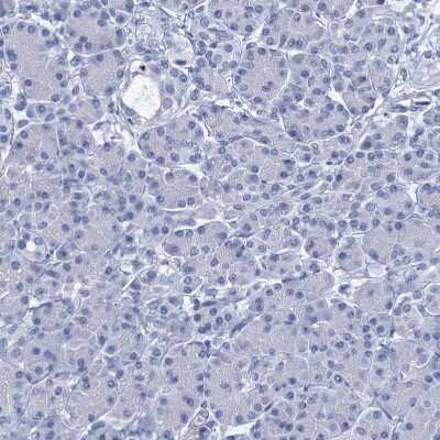 Immunohistochemistry-Paraffin: RHCG Antibody [NBP2-30825]