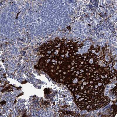 Immunohistochemistry-Paraffin: RHCG Antibody [NBP2-30825]