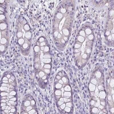 Immunohistochemistry-Paraffin: RHCG Antibody [NBP2-30905]