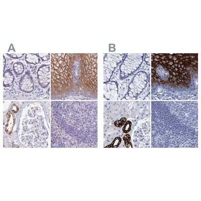 Immunohistochemistry-Paraffin: RHCG Antibody [NBP2-30905]
