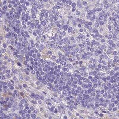 Immunohistochemistry-Paraffin: RHCG Antibody [NBP2-30905]