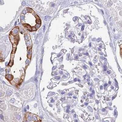Immunohistochemistry-Paraffin: RHCG Antibody [NBP2-30905]