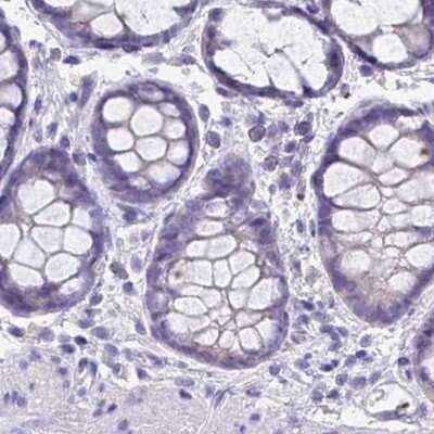 Immunohistochemistry-Paraffin: RHCG Antibody [NBP2-30905]