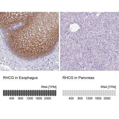 Immunohistochemistry-Paraffin: RHCG Antibody [NBP2-30905]