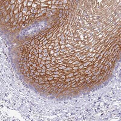 Immunohistochemistry-Paraffin: RHCG Antibody [NBP2-30905]