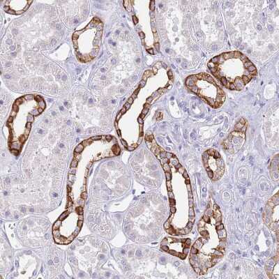 Immunohistochemistry-Paraffin: RHCG Antibody [NBP2-30905]