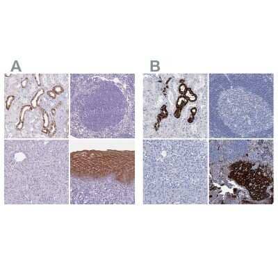 Immunohistochemistry-Paraffin: RHCG Antibody [NBP2-30905]