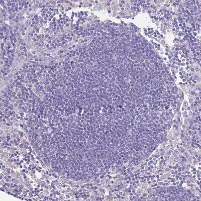 Immunohistochemistry-Paraffin: RHCG Antibody [NBP2-30905]