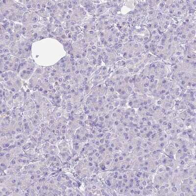 Immunohistochemistry-Paraffin: RHCG Antibody [NBP2-30905]