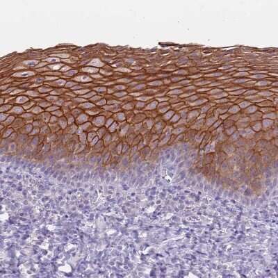 Immunohistochemistry-Paraffin: RHCG Antibody [NBP2-30905]