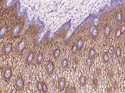 Immunohistochemistry-Paraffin: RHCG Antibody [NBP2-97617]