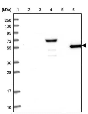 Western Blot: RHCG Antibody [NBP2-30905]