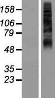 Western Blot: RHCG Overexpression Lysate [NBP2-07055]