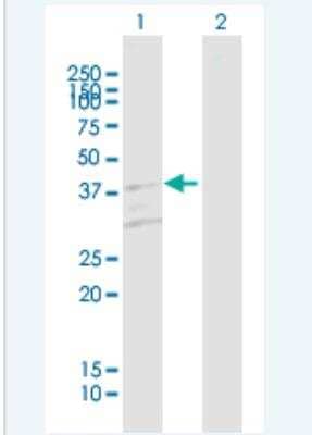 Western Blot: RHD Antibody [H00006007-B01P-50ug]