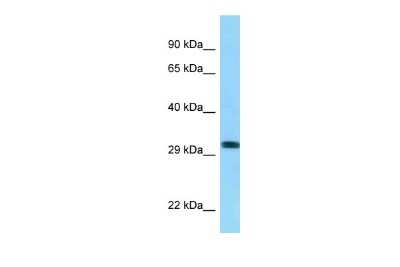 Western Blot: RHD Antibody [NBP2-84247]