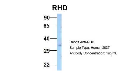 Western Blot: RHD Antibody [NBP2-84247]