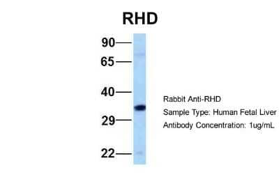 Western Blot: RHD Antibody [NBP2-84247]