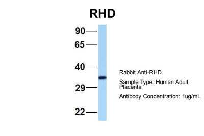 Western Blot: RHD Antibody [NBP2-84247]
