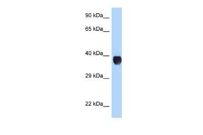 Western Blot: RHD Antibody [NBP2-84248]