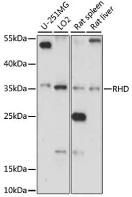 Western Blot: RHD AntibodyAzide and BSA Free [NBP2-95170]