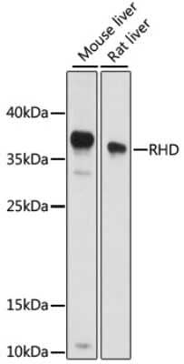 Western Blot: RHD AntibodyAzide and BSA Free [NBP2-95171]