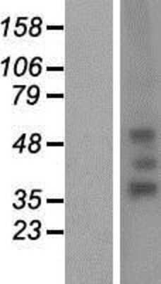 Western Blot: RHD Overexpression Lysate [NBP2-07087]