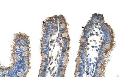 Immunohistochemistry-Paraffin: RHOBTB1 Antibody [NBP1-58908]