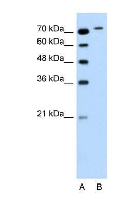 Western Blot: RHOBTB1 Antibody [NBP1-58908]