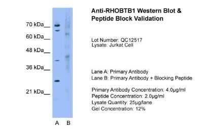 Western Blot: RHOBTB1 Antibody [NBP1-58908]