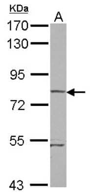 Western Blot: RHOBTB1 Antibody [NBP2-20155]