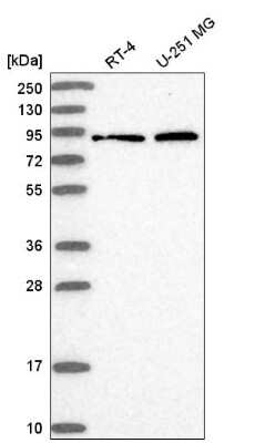 Western Blot: RHOBTB1 Antibody [NBP2-55210]