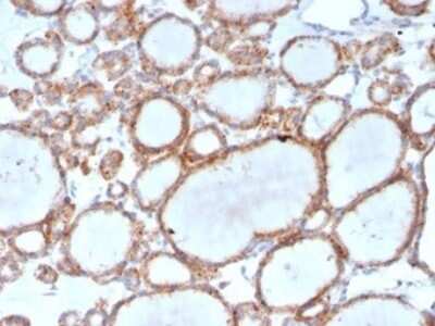 Immunohistochemistry-Paraffin: RHOBTB2 Antibody (DBC2/3361) [NBP3-13899]