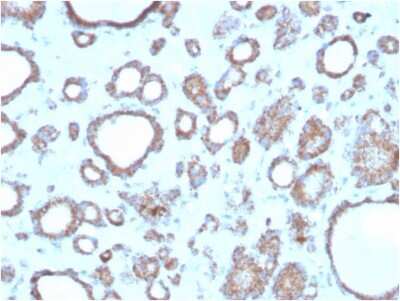 Immunohistochemistry-Paraffin: RHOBTB2 Antibody (DBC2/3362) [NBP3-07429]