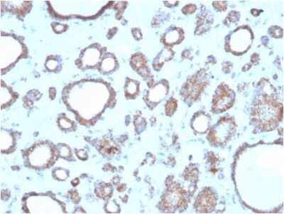 Immunohistochemistry-Paraffin: RHOBTB2 Antibody (DBC2/3362) - Azide and BSA Free [NBP3-08659]