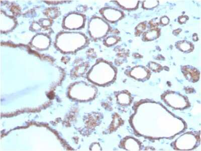 Immunohistochemistry-Paraffin: RHOBTB2 Antibody (DBC2/3362) - Azide and BSA Free [NBP3-08659]