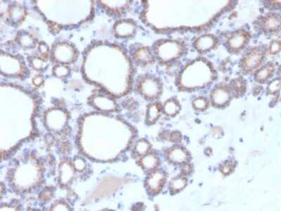 Immunohistochemistry-Paraffin: RHOBTB2 Antibody (DBC2/3364) [NBP3-07485]