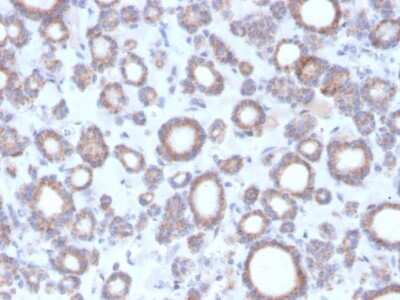 Immunohistochemistry-Paraffin: RHOBTB2 Antibody (DBC2/3364) - Azide and BSA Free [NBP3-08806]